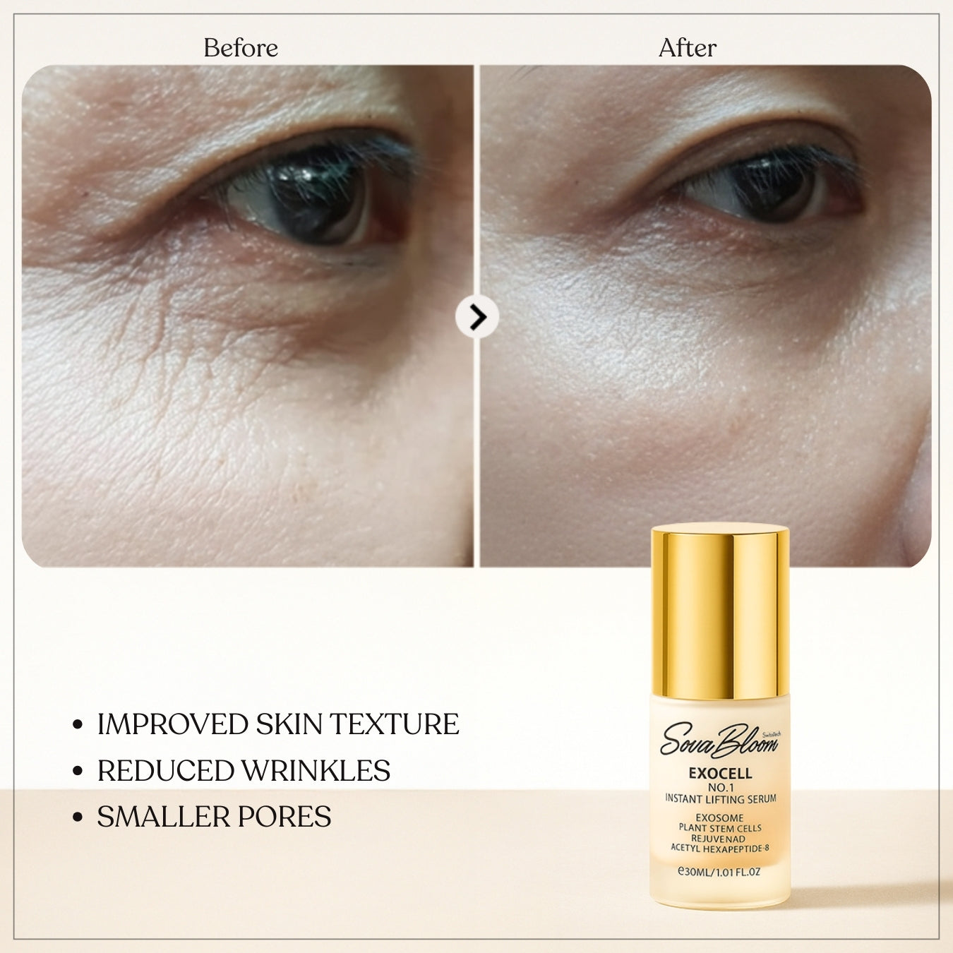 Exocell No.1 Instant Lifting Serum