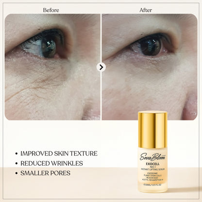 Exocell No.1 Instant Lifting Serum