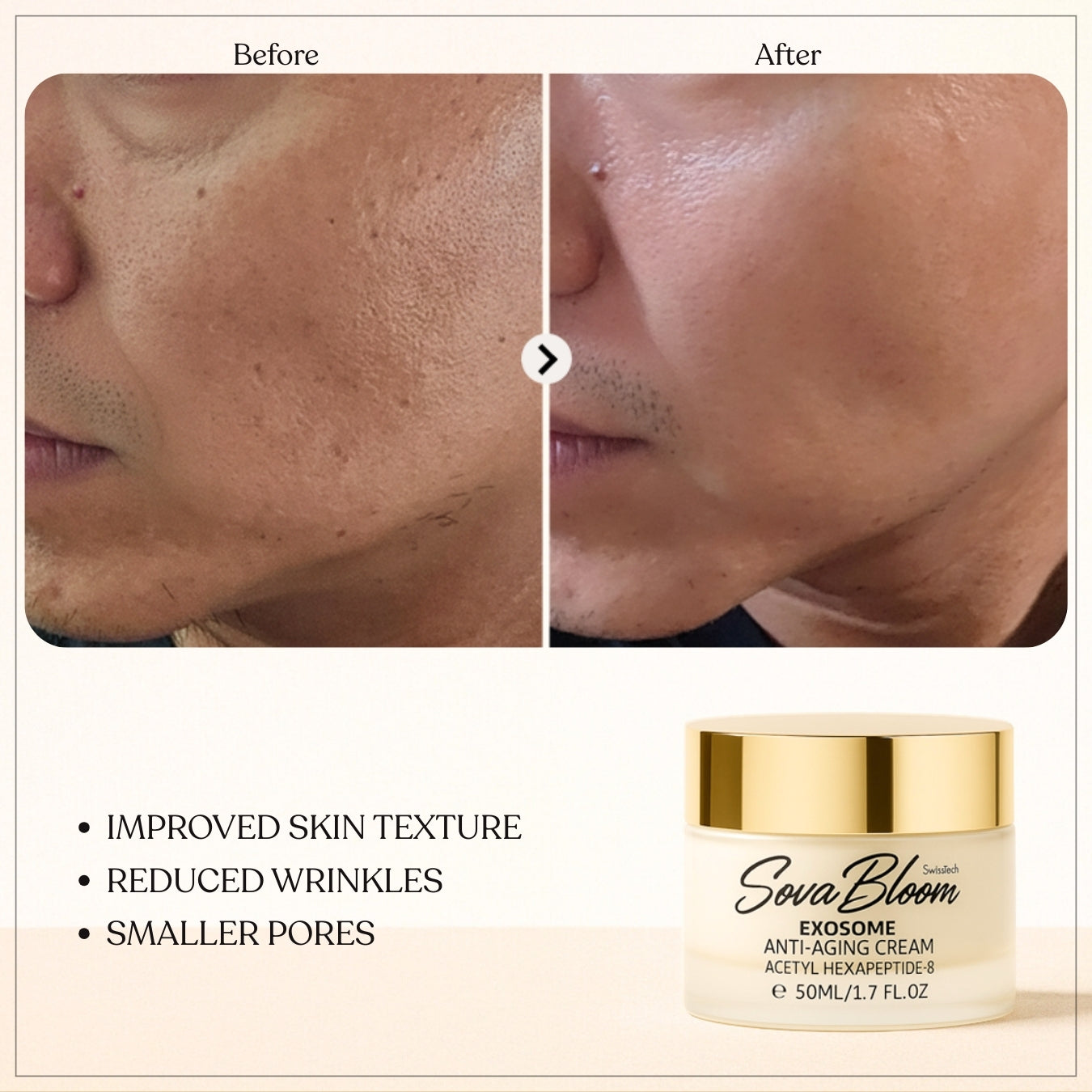Exosome Anti-Aging Cream – SovaBloom