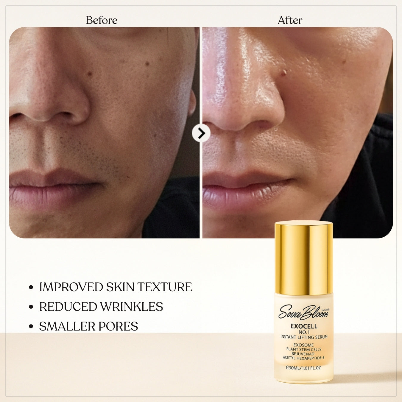 Exocell No.1 Instant Lifting Serum