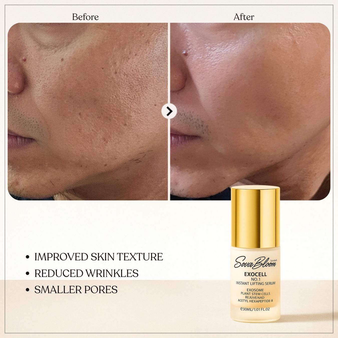 Exocell No.1 Instant Lifting Serum