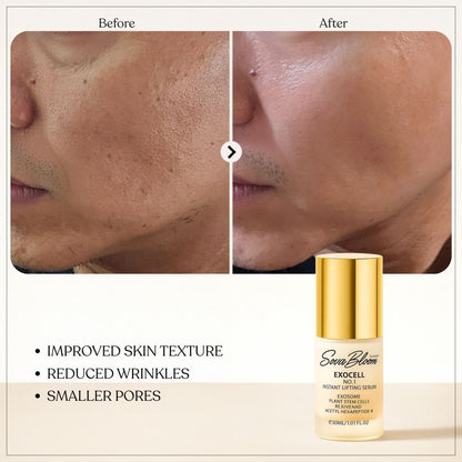 Exocell No.1 Instant Lifting Serum