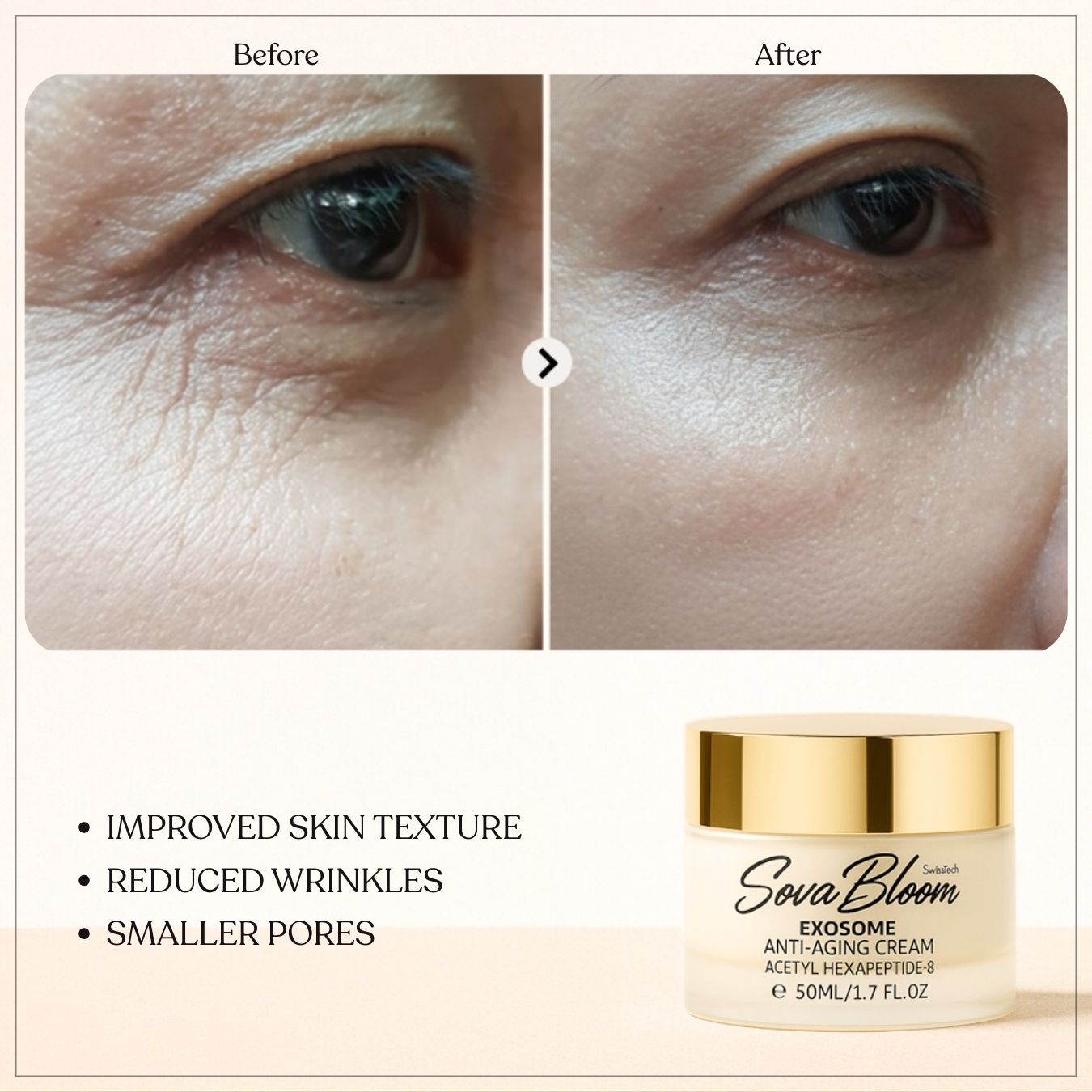 Exosome Anti-Aging Cream – SovaBloom