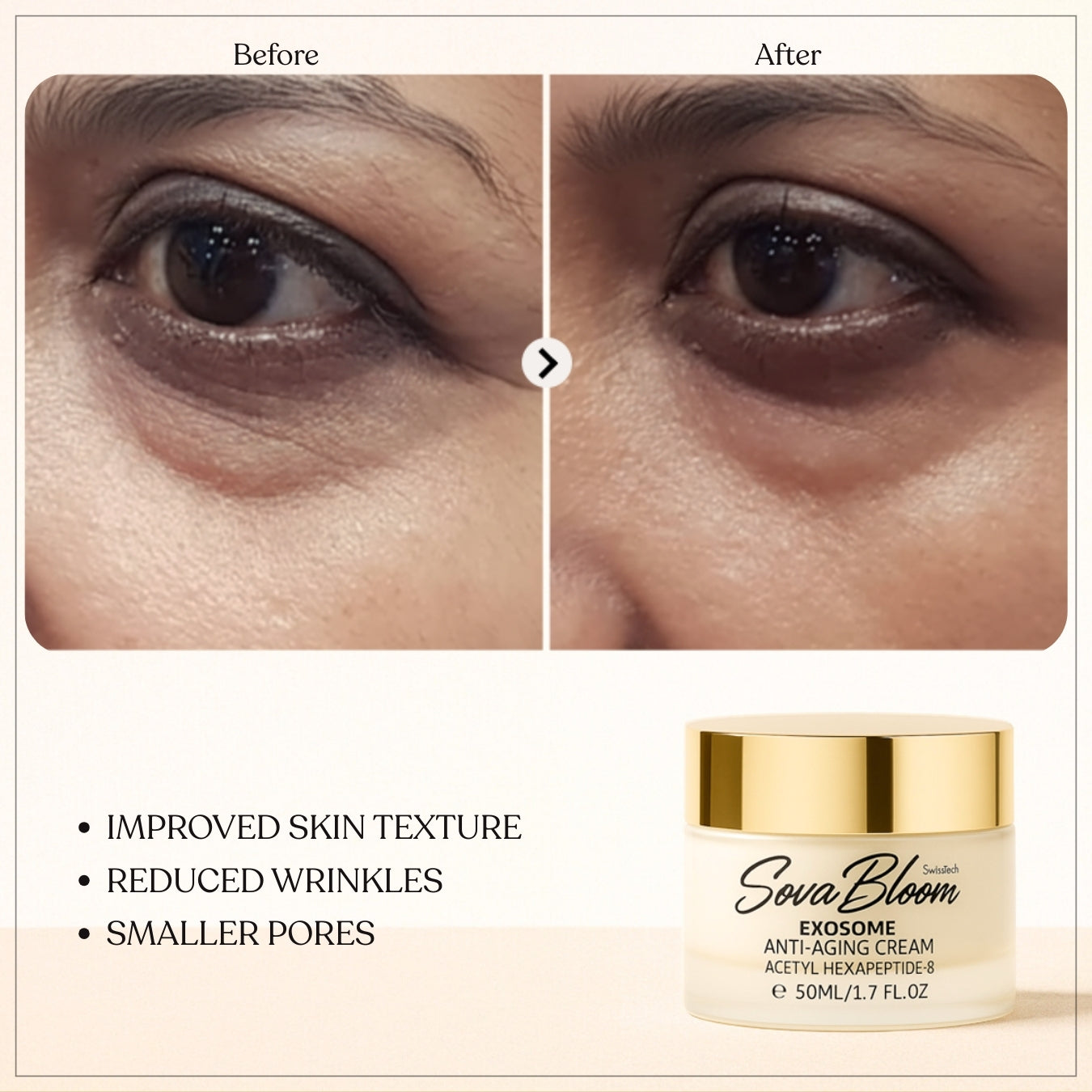 Exosome Anti-Aging Cream – SovaBloom